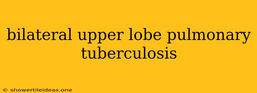 Bilateral Upper Lobe Pulmonary Tuberculosis