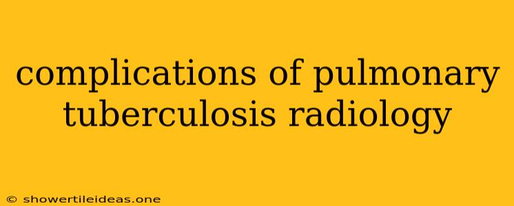 Complications Of Pulmonary Tuberculosis Radiology