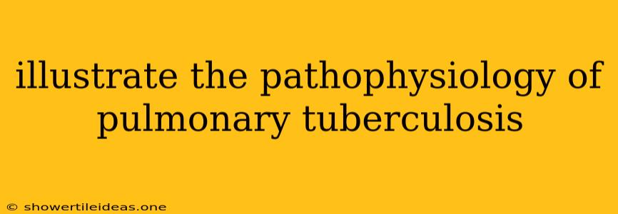 Illustrate The Pathophysiology Of Pulmonary Tuberculosis