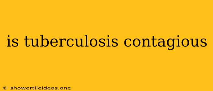 Is Tuberculosis Contagious